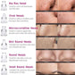 6 in 1 Multi-function Blackhead Remover Tools