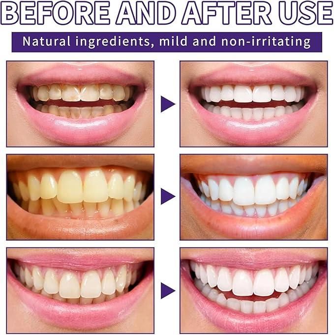 Teeth Restoration Mineral Powder (50gm Pack of 1)